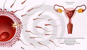 Microscopic Sperm Cells Around of Human Egg Banner photo