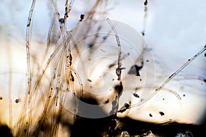 Microscopic view of aspergillus fungi hyphae