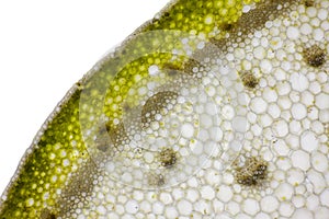 Microscopic view of Bearded iris Iris, x germanica plant stem