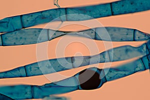 Microscopic View of Blue-Stained Fungal Hyphae