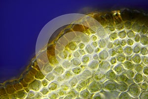 Microscopic view of Border forsythia (Forsythia x intermedia) stem cross-section