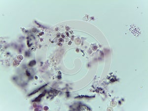 Microscopic View of a Colonial Green Alga, Pediastrum, Amidst