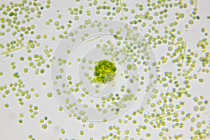 Microscopic view of colonial green algae Coelastrum between single-cell algae