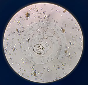 Microscopic view of cystine crystal
