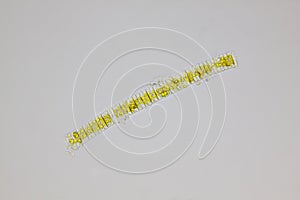 Microscopic view of a diatom colony