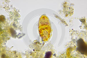 Microscopic view of a diatom and detritus