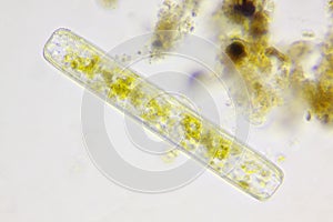 Microscopic view of a diatom Navicula