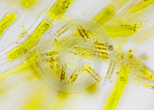 Microscopic view of a diatoms Diatoma between algae cells photo