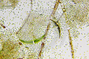 Microscopic view of different types of algae