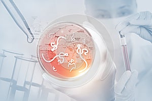 Microscopic view of the Ebola virus.