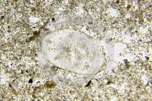 Microscopic view of Foraminifera test (shell) extracted from silurian limestone photo