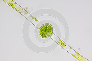 Microscopic view of freshwater green algae (Oedogonium) filament with oogonium