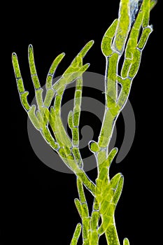 Microscopic view of green algae Cladophora branch
