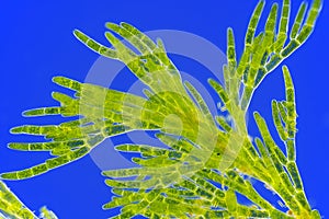 Microscopic view of green algae Cladophora photo