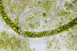 Microscopic view of green algae filament between detritus