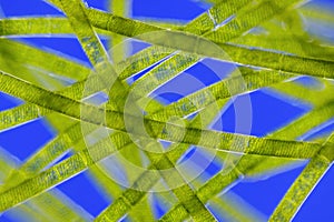 Microscopic view of green algae (Spirogyra)