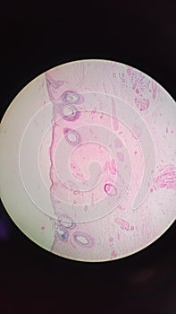 MICROSCOPIC VIEW OF HUMAN THIN SKIN