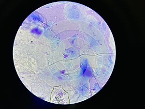 Microscopic view of Malassezia pachydermatis cells taken from dog with ear infection