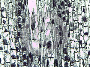 Microscopic View of Metaphase and Interphase Cells in Plant T