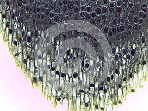 Microscopic View of Metaphase and Interphase Cells in Plant Ti