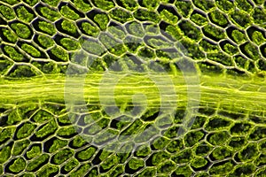 Microscopic view of moss leaf Plagiomnium affine