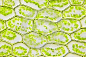 Microscopic view of moss leaf Plagiomnium affine