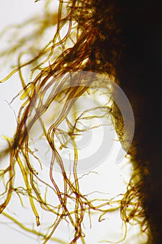 Microscopic view of moss rhizoids