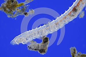Microscopic view of Oligochaete worm