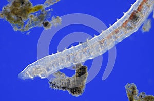 Microscopic view of Oligochaete worm photo