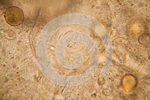 Microscopic view of organisms in the fusty water