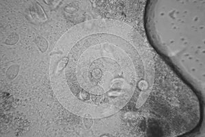 Microscopic view of organisms in the fusty water. Paramecium caudatum