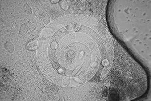 Microscopic view of organisms in the fusty water. Paramecium caudatum