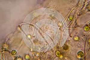 Microscopic view of organisms in the fusty water