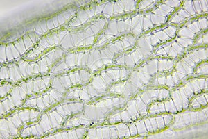 Microscopic view of peat moss (Sphagnum) leaf detail