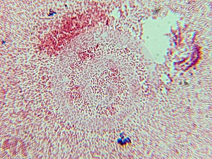 Microscopic View of Purple Cocci Bacteria Clustered in Grapelike Formation