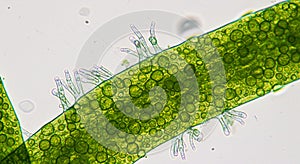 Microscopic view of Spirogyra, a filamentous green algae. Cylindrical cells form photo