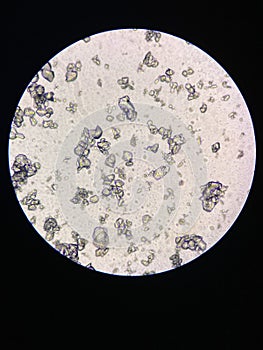 Microscopic view of struvite crystals from urinary sediment. Magnesium ammonium phospate crystals. Causing Feline Lower Urinary