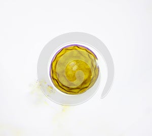 Microscopic view of testate amoeba Arcella shell