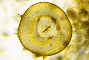 Microscopic view of testate amoeba Centropyxis aculeata shell