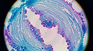 Microscopic view of a tissue sample stained with hematoxylin and