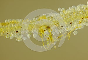 Microscopic view of unspecified eggs on Common duckweed Lemna m