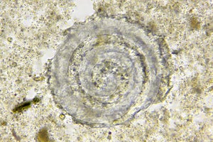 Microscopic view of unspecified marine microfossil extracted from silurian limestone