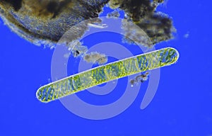 Microscopic view of young green algae (Spirogyra) cells