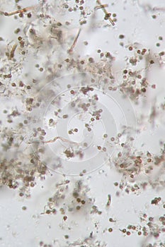 Microscopic volatile spores of puffball fungus. Lycoperdon, Basidiomycota is a genus of puffball mushrooms photo