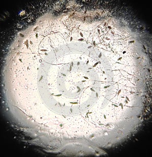 Microscopy of the Alternaria fungal mycelium