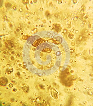 Microscopy of the Alternaria fungus