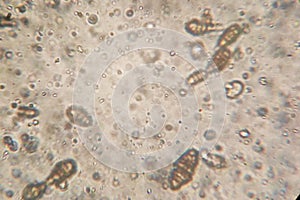 Microscopy of the Alternaria fungus macroconidia