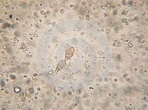 Microscopy of the Alternaria fungus macroconidia
