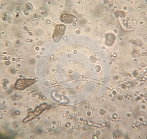 Microscopy of Alternaria spores