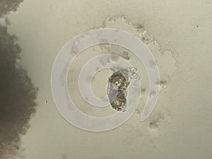 Candida albicand and bacterial colonies under the microscope